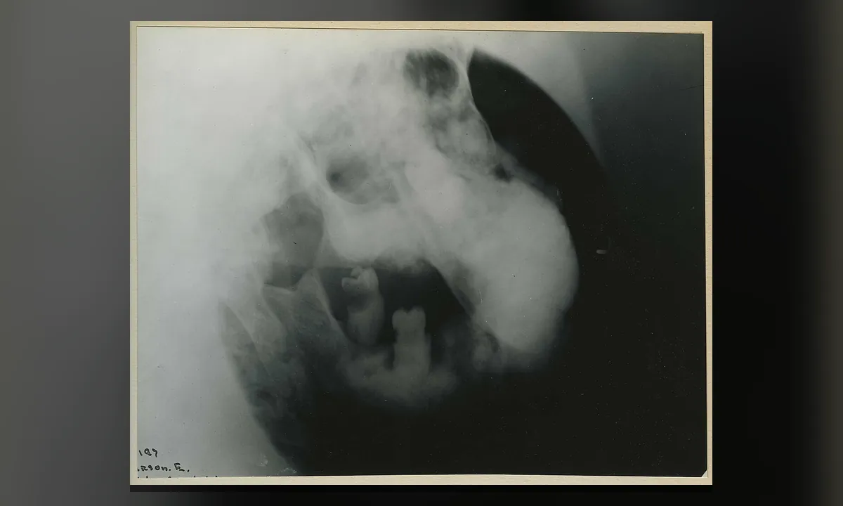 Imagen principal sobre El dolor
