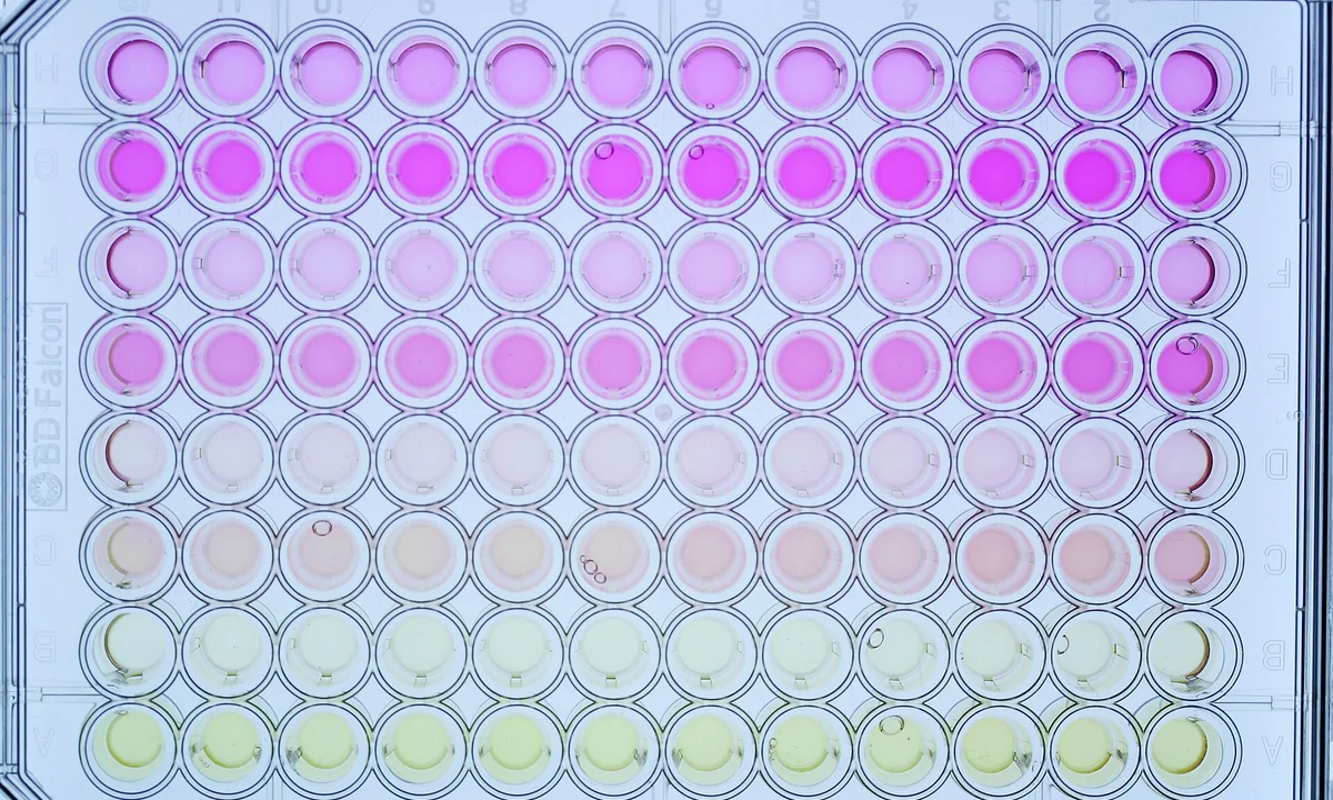 Imagen principal sobre El metabolismo celular