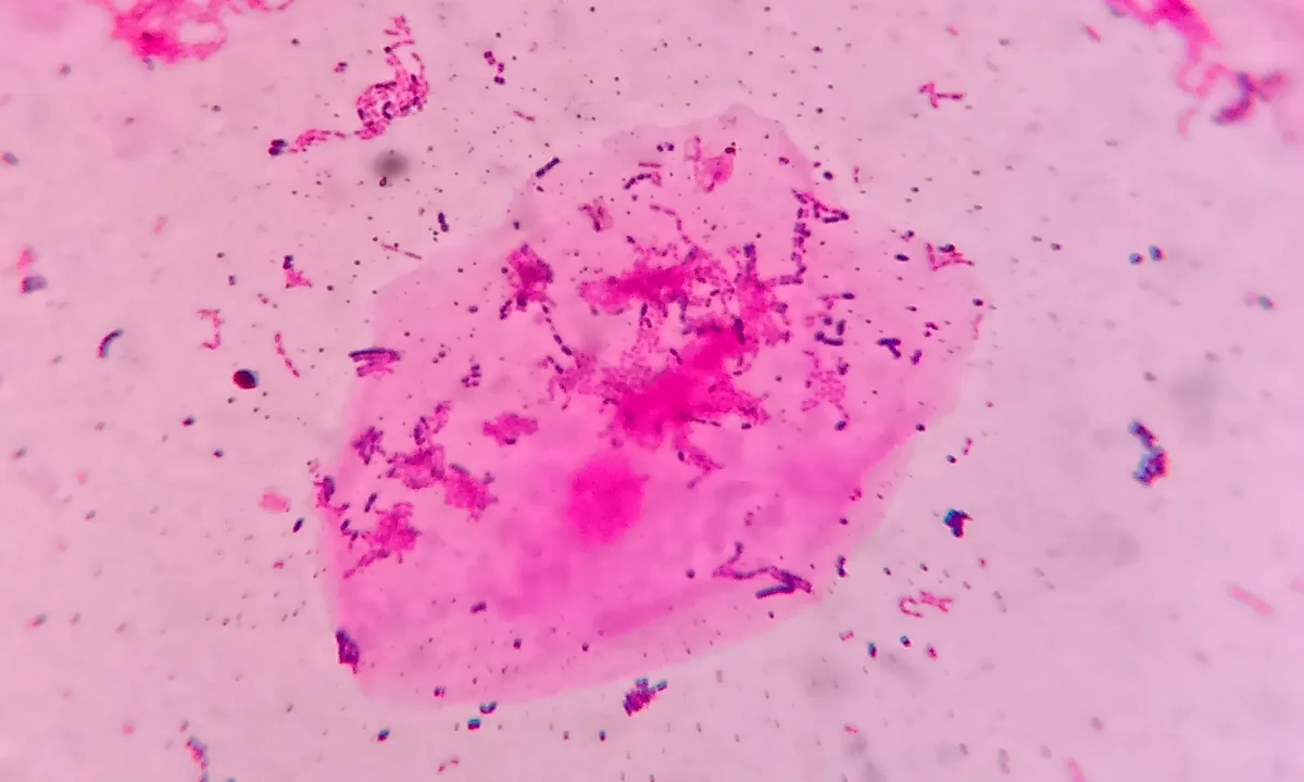 Imagen principal sobre El microbioma oral