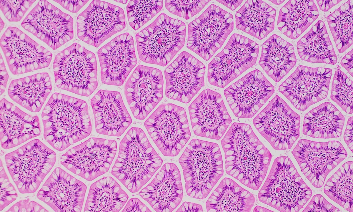 Imagen principal sobre La barrera intestinal