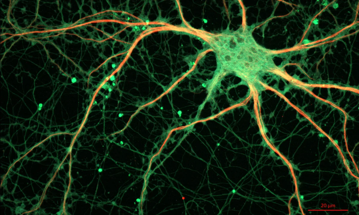 Imagen principal sobre La neurogénesis