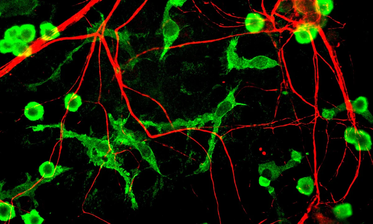 Imagen principal sobre La neuroinflamación
