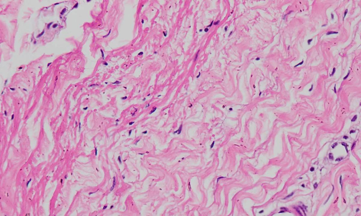 Imagen principal sobre Los biomateriales